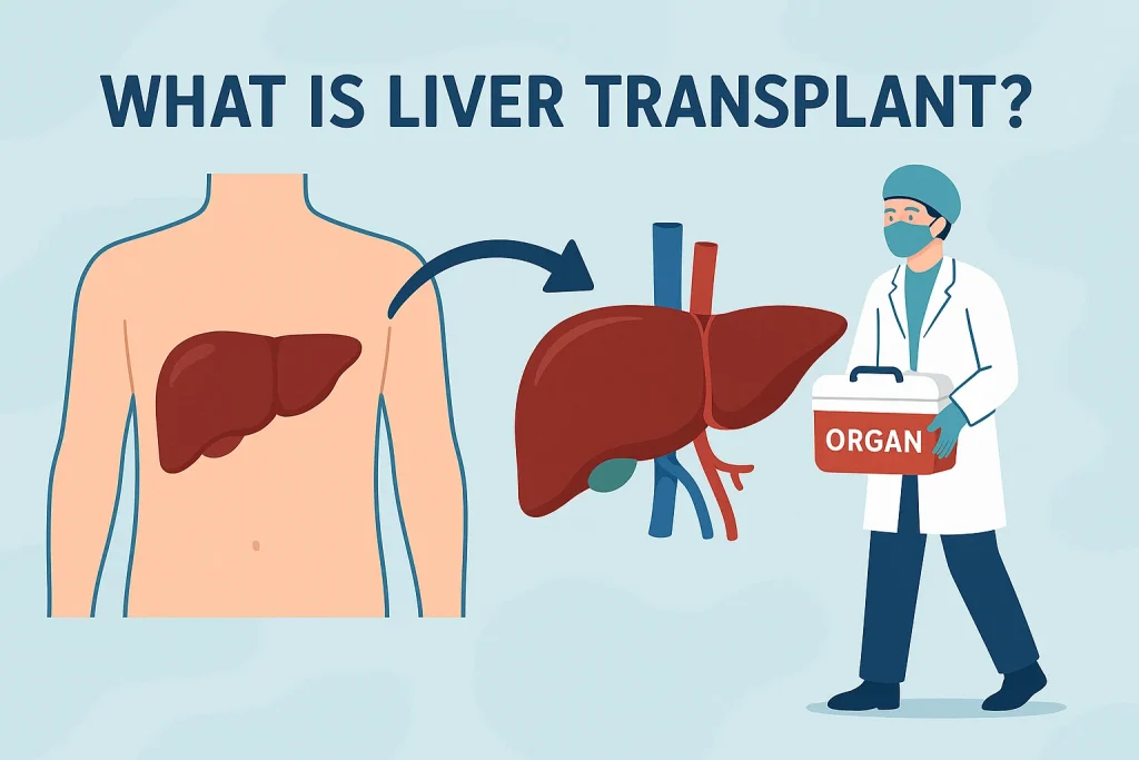 What Is a Liver Transplant photo and picture