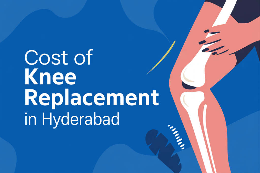Image of Cost of Knee Replacement in Hyderabad Cost of Knee Replacement in Hyderabad photo and picture